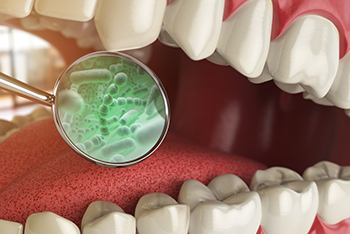 3：口腔内細菌のバランス