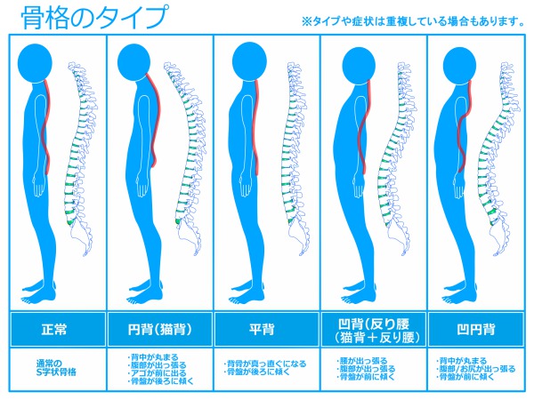 骨格のタイプ｜姿勢と噛み合わせや歯並びの意外な関係