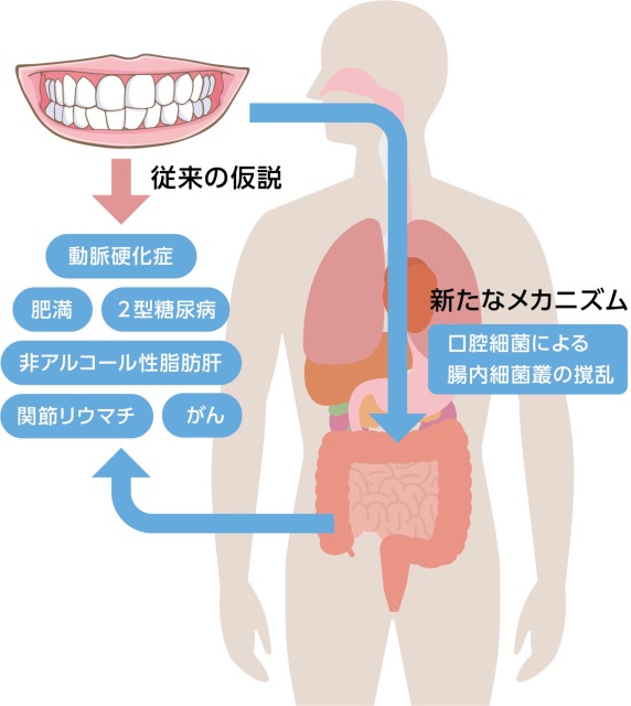 口腔細菌と腸内細菌叢と疾患の関係｜「お口の問題」と「身体の不調や病気」はつながっている！？｜歯科医師会田の噛み合わせメディア-カムシル