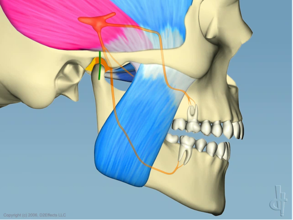 慢性頭痛、顎の疲労・歪みを引き起こす噛み合わせの治療例｜顎の筋肉の図