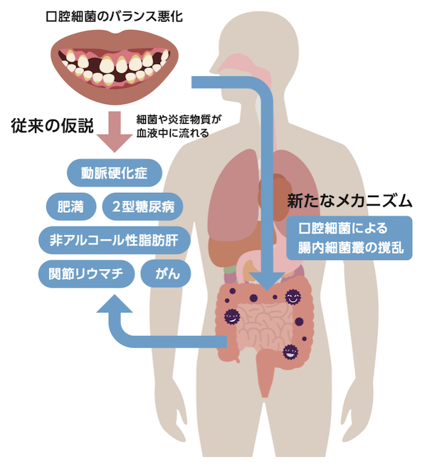 歯科医師会田の噛み合わせメディア〜カムシル〜｜皮膚科で治らないその症状、歯科医院で治る可能性も｜口腔細菌と腸内細菌の関係図